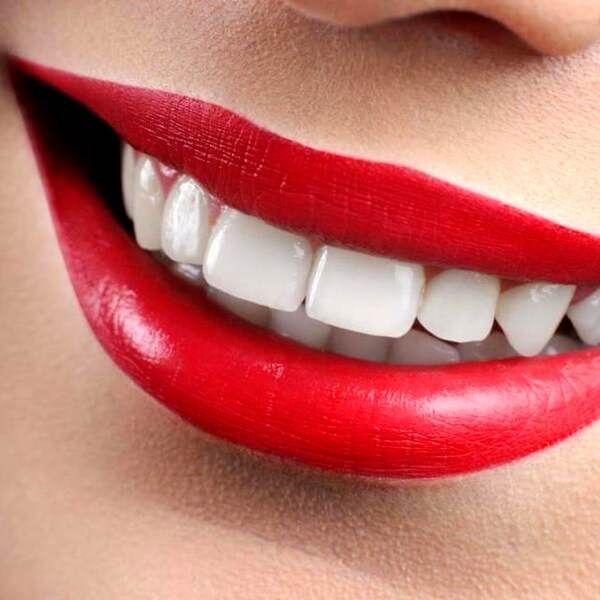6 Things You Should Know Before Getting a Dental Filling. (#6 Will Surprise You!)