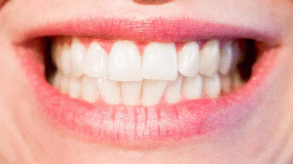 DAILY HABITS THAT HAVE BEEN DAMAGING YOUR TEETH!