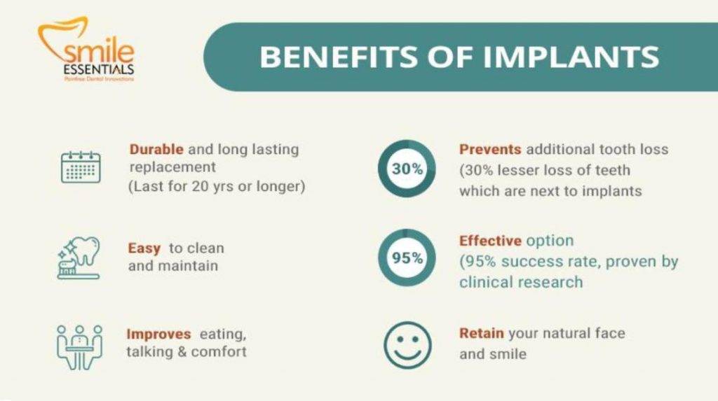 What do Dental implants really cost?